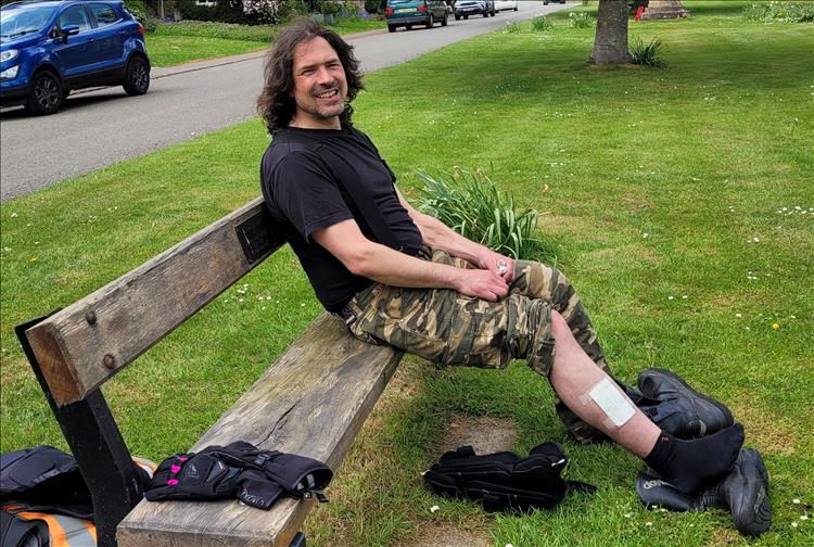 Ren show us his leg complete with a taped on dressing to keep his wound clean