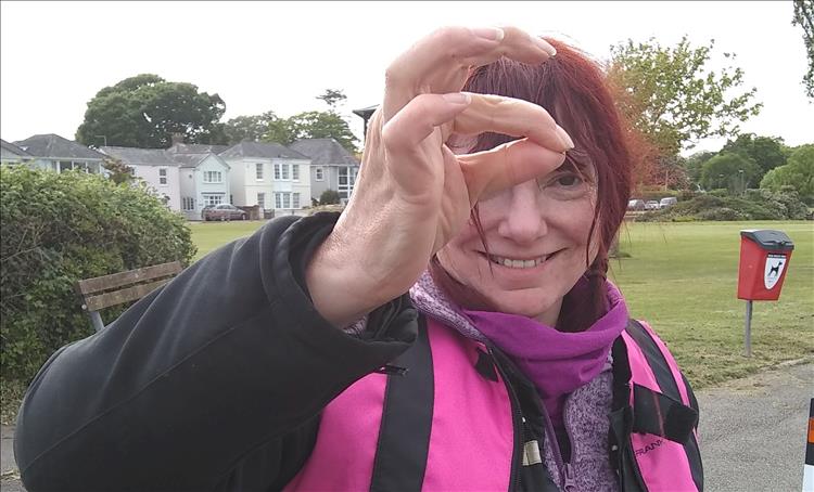 Sharon holds a very small amount of her hair that was pulled out by her helmet strap