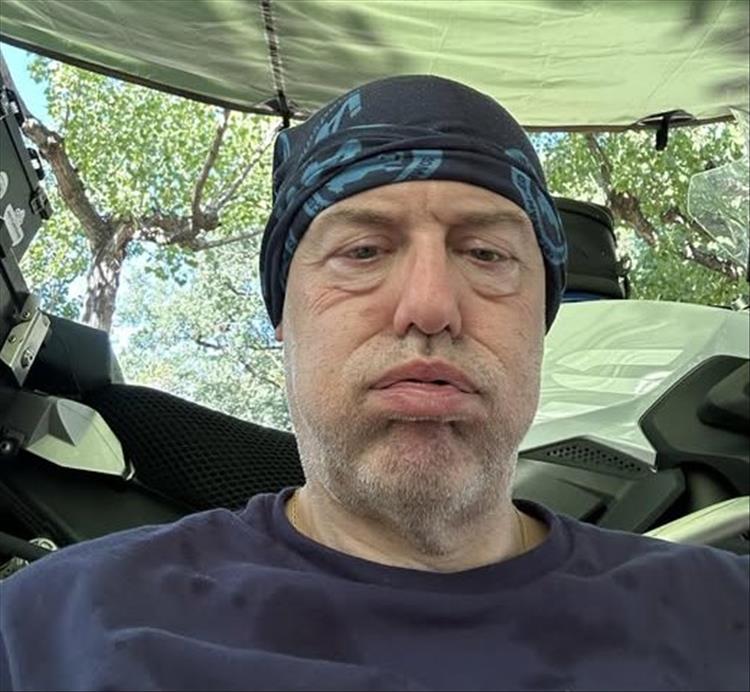 Andy looking grey and ill under a tarp on the campsite